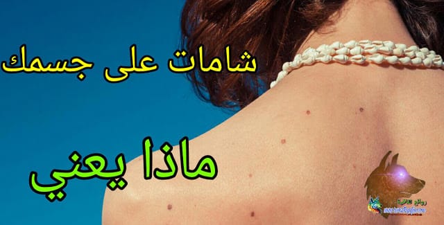 ماذا يعني وجود شامات على جسمك